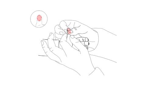 【保山安利醫(yī)院】冬季孩子脾胃濕，小兒推拿教你如何健脾祛濕