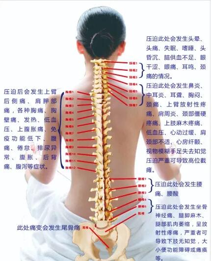保護(hù)腰椎—示范腰椎保健操，趕快收藏吧