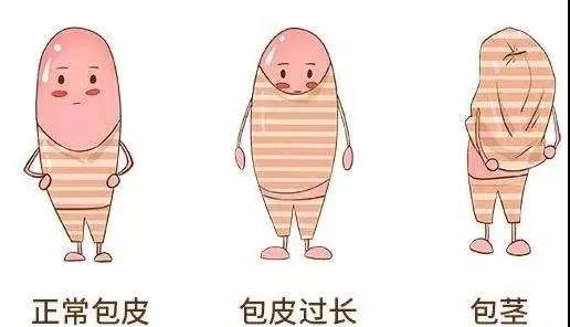 【保山安利醫(yī)院】家長速看！暑期包皮手術(shù)預(yù)約正當(dāng)時！