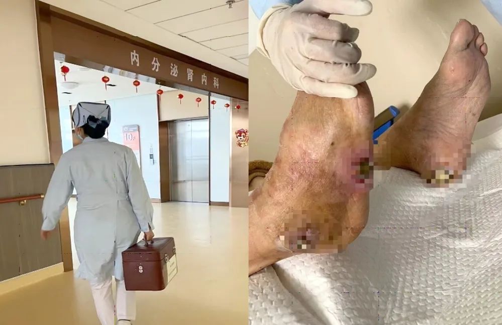 【保山安利醫(yī)院】傷口治療一站式，健康生活零距離！